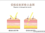 角质层薄多久能修复好_角质层薄有红血丝修复时间需要多久